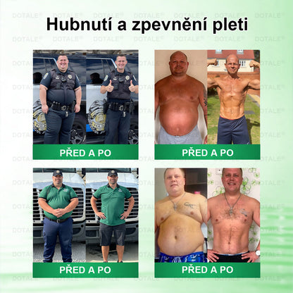 Poslední šance! Nenechte si ujít tuto příležitost se slevou 50 %! | 𝑫𝑶𝑻𝑨𝑳𝑬® Metabolická Nano Mikroneedlová Náplast