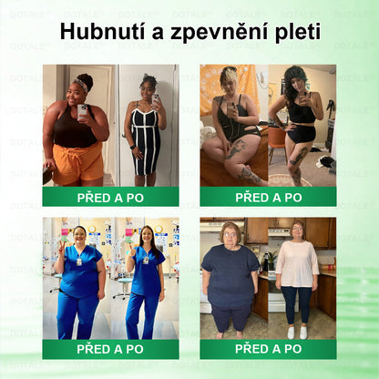 Poslední šance! Nenechte si ujít tuto příležitost se slevou 50 %! | 𝑫𝑶𝑻𝑨𝑳𝑬® Metabolická Nano Mikroneedlová Náplast