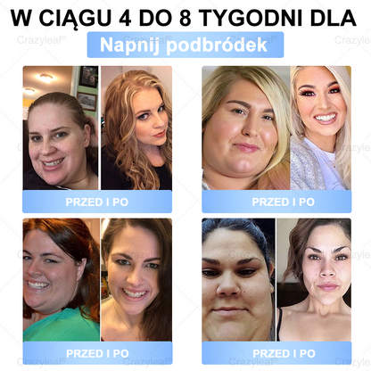 ✨𝐂𝐫𝐚𝐳𝐲𝐋𝐞𝐚𝐟® 𝐒𝐌𝐆𝐓-𝐆𝐋𝐏-𝟏 𝐏𝐥𝐚𝐬𝐭𝐫𝐲 – 𝐒𝐩𝐚𝐥𝐚𝐧𝐢𝐞 𝐭ł𝐮𝐬𝐳𝐜𝐳𝐮, 𝐔𝐣ę𝐝𝐫𝐧𝐢𝐞𝐧𝐢𝐞, 𝐏𝐨𝐳𝐢𝐨𝐦 𝐜𝐮𝐤𝐫𝐮 • 𝐄𝐟𝐞𝐤𝐭𝐲 𝐰 𝟕 𝐝𝐧𝐢, 𝐛𝐞𝐳 𝐳𝐚𝐬𝐭𝐫𝐳𝐲𝐤ó𝐰