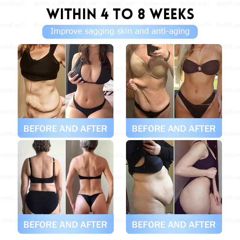 FDA Store |𝐵uil𝗱𝐿ea𝐟® 𝑮𝐋𝑃-1 Slim & Firm 𝑁ano 𝑀icroneedle 𝑃atch with Collagen,Turmeric&Matrixyl 3000 丨Obesity,Cardiovascular Diseas, Diabetes, Sleep Apnea, Joint Problems and More