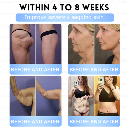 FDA Store |𝐵uil𝗱𝐿ea𝐟® 𝑮𝐋𝑃-1 Slim & Firm 𝑁ano 𝑀icroneedle 𝑃atch with Collagen,Turmeric&Matrixyl 3000 丨Obesity,Cardiovascular Diseas, Diabetes, Sleep Apnea, Joint Problems and More